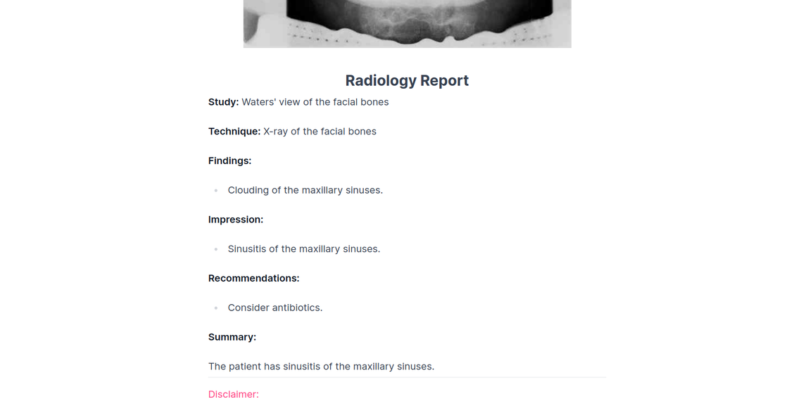 X-ray Interpreter-превью