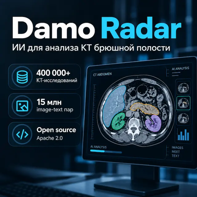 Damo Radar