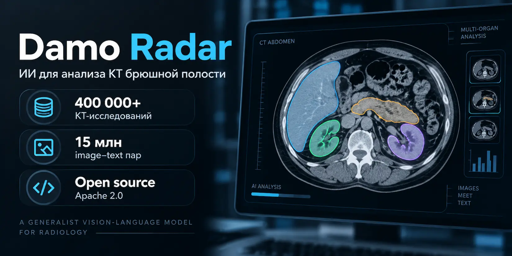 Скриншот ИИ-сервиса Damo Radar